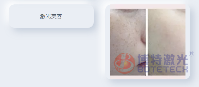 激光工藝 激光工藝